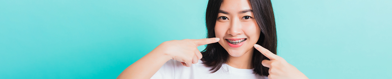 invisalign clear braces