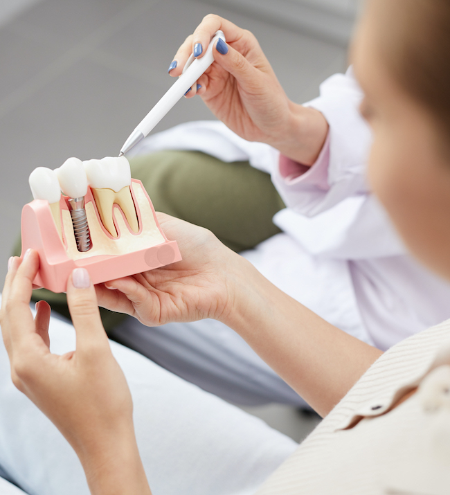 Dental Implants DentalImplants