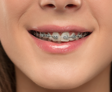 Kent Dental Works