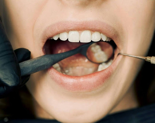 Dental examination showing a mirror reflecting a tooth