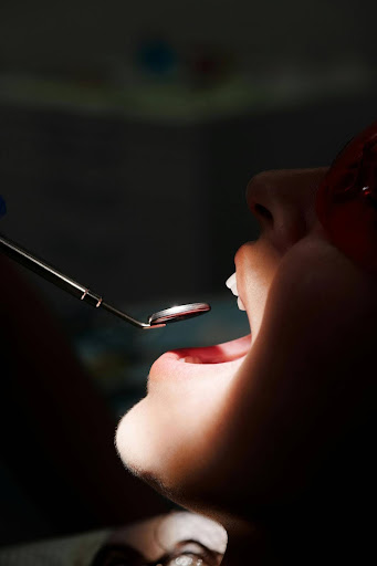 A patient's open mouth with a dental mirror during a check-up