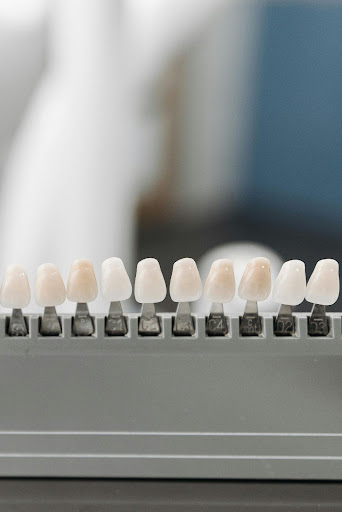 A full dental shade guide showing a range of tooth colors