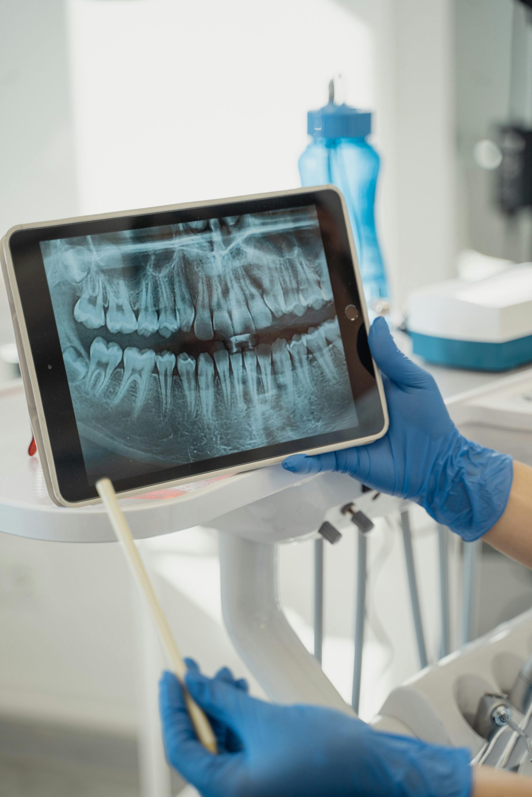dentist-showing-panoramic-xray-on-digital-tablet A dentist using a tablet to review a panoramic dental X-ray during a patient consultation