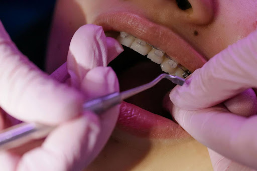 A patient receiving a dental adjustment with braces