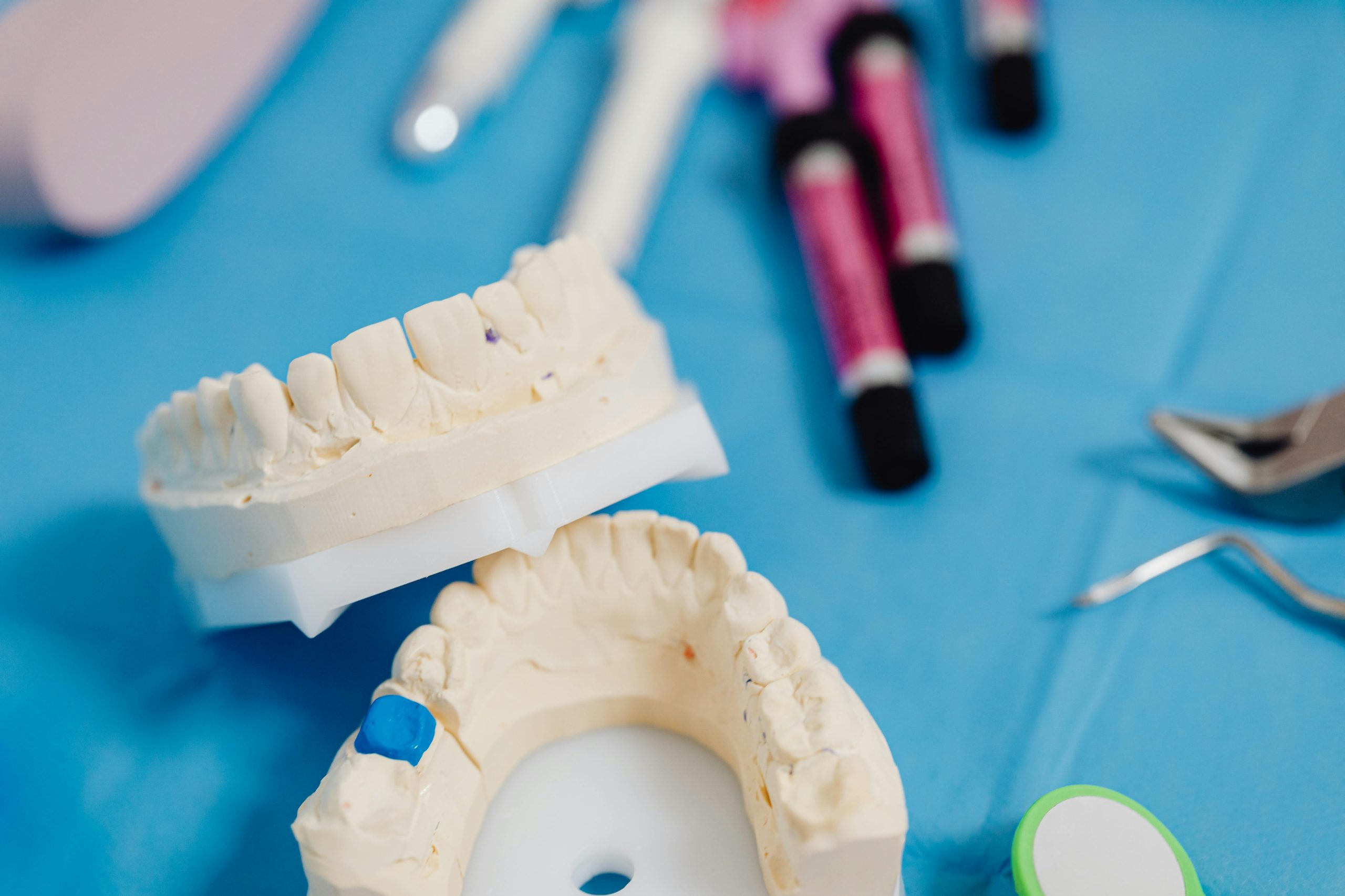 Dental jaw model showing a restoration site for crowns and bridges
