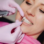 Dentist matching a patient's tooth shade